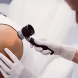 Dermatolog w białej rękawiczce bada skórę pacjenta dermatoskopem.
